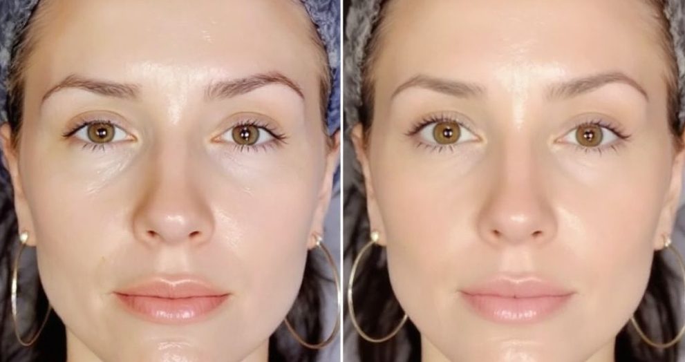 russian face massage vs gua sha